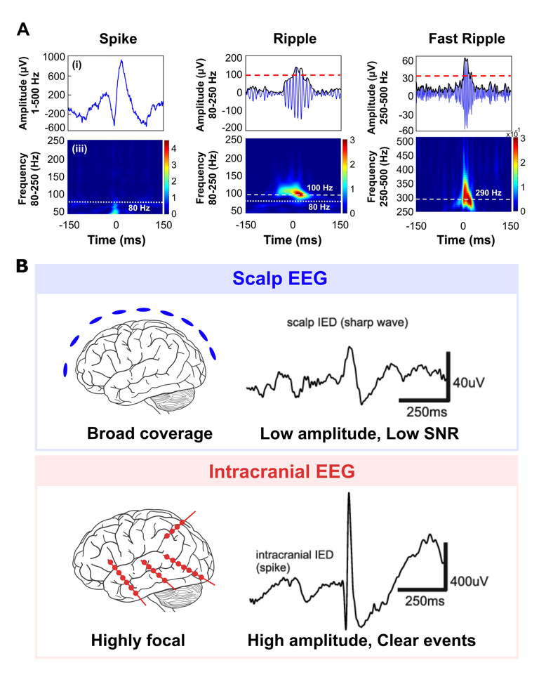 A Review of Artificial Intelligence-Based Methods for the Detection of ...