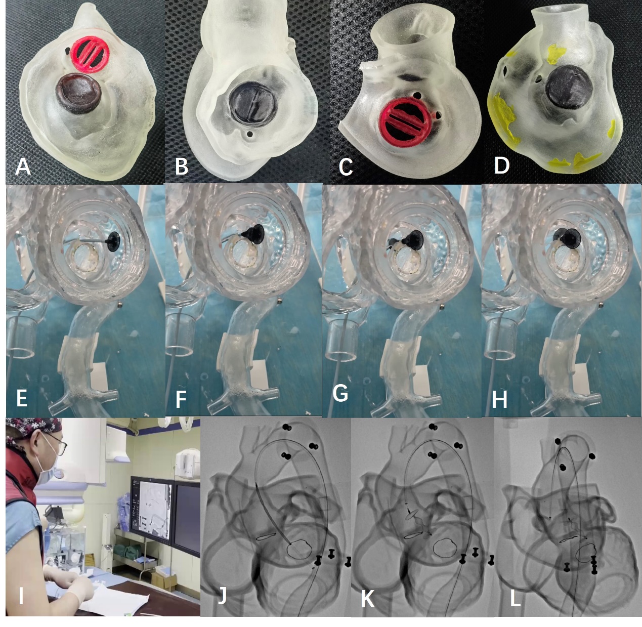 Clinical Applications of Three-Dimensional Printing in Valvular Heart ...